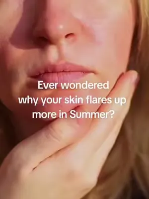 3 Tips for Managing Rosacea this Summer:  💜 Apply SPF daily 💜 Stay cool & hydrated 💜 Learn your triggers  #rosacea #rosalique #flareup #Summer #skincare 