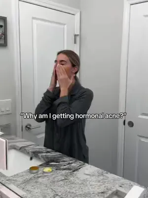 SAVE THIS POST AND FOLLOW US ⬇️✨ 💡 “Why am I getting hormonal acne?” It’s not always your hormones, they’re just reacting to external triggers. Many everyday products and habits can overwhelm your sys