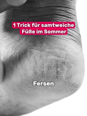Rissige Fersen im Sommer? Nie wieder!  Deine Füße haben den Sommer verdient. Einfach die Fußmasken-Socken überziehen, 30–60 Minuten einwirken lassen und fertig. In den nächsten Tagen erledigt die Mask
