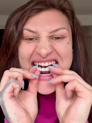 Danke, Lony, für dein tolles Feedback zu unseren Zahn-Veneers 2.0! Dein Lächeln strahlt wirklich förmlich! 😍 Lony beantwortet viele hilfreiche Fragen und zeigt, wie einfach es ist, unser Produkt zu nu