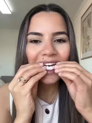Ultradünne, stabile & maßgeschneiderte Veneers für dein perfektes Hollywood-Lächeln! Danke Narin für das beeindruckende Ergebnis! ✨ Sichere jetzt dein Traumlächeln! 😁 🔗 Link in Bio! #veneera #veneers 