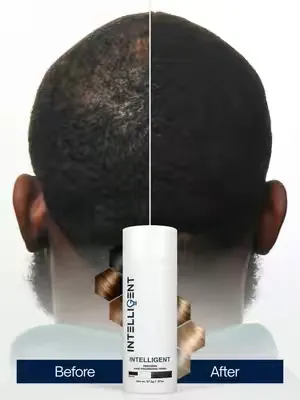 The hardest part of thinning hair isn't always the mirror. It’s wondering how your hair looks under bright lights, in photos, or from every angle throughout the day. INTELLIGENT Precision Hair-Volumiz