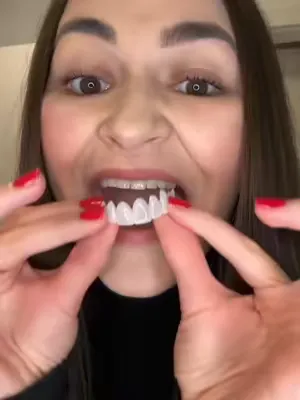 Monika hat uns gerade ein Video geschickt, in dem sie stolz ihr neues Lächeln von Veneera™ zeigt – und wir sind total begeistert! 😍 Es sieht nicht nur frisch und natürlich aus, sondern auch unglaublic