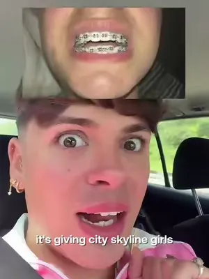 “I had braces… and then stopped wearing my retainers.” 👀 @Iamcharlielee starting his journey with Smile White to get his smile back on track. If this sounds familiar, you’re definitely not alone. Roun